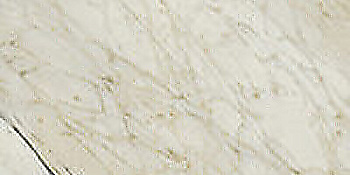 SERENISSIMA Palazzo Palladiana Mix Champa 60x120